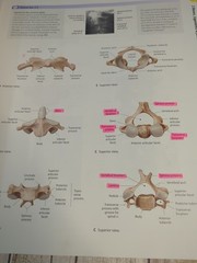 Atlas of Anatomy – Paperback By Gilroy, Anne M – GOOD