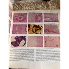 1972 Color Atlas of Histopathology Medical Reference Book by R.C. Curran Oxford
