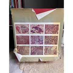 1972 Color Atlas of Histopathology Medical Reference Book by R.C. Curran Oxford
