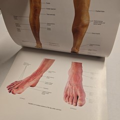 A Brief Atlas of the Skeleton, Surface Anatomy, Medical Images – Gerard J