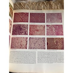 1972 Color Atlas of Histopathology Medical Reference Book by R.C. Curran Oxford