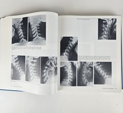 Atlas of Normal Roentgen Variants That May Simulate Disease 5thTheodore E. Keats