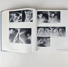Atlas of Normal Roentgen Variants That May Simulate Disease 5thTheodore E. Keats