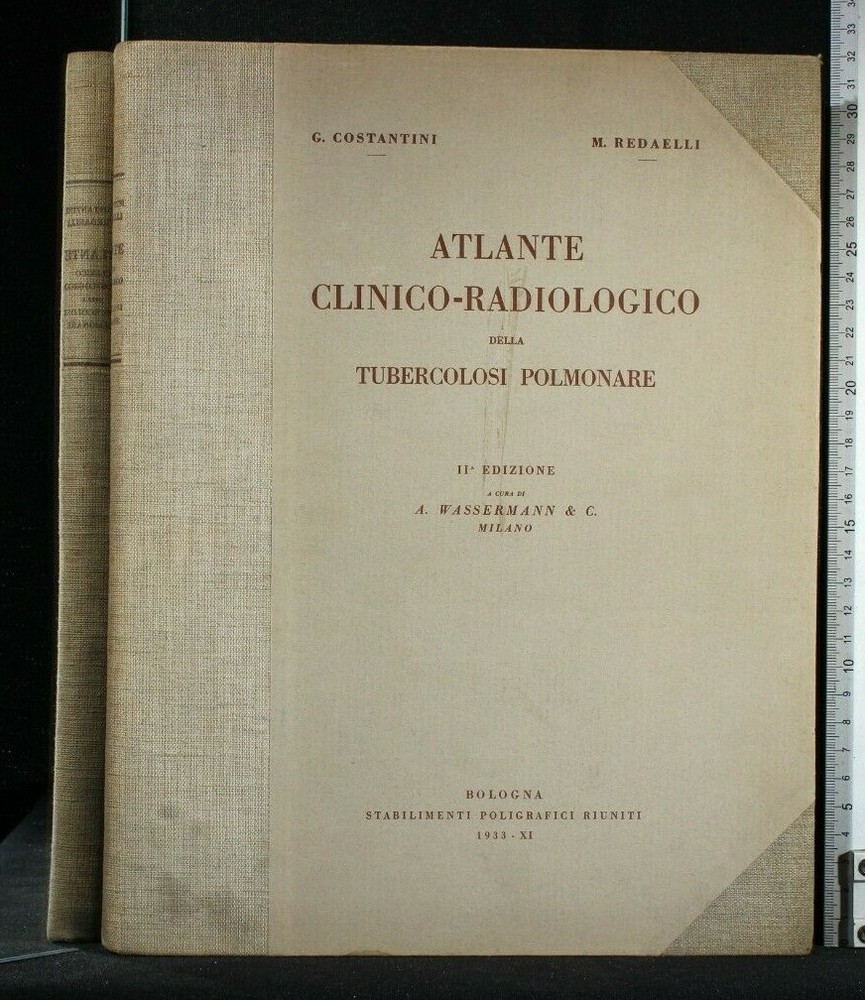 ATLANTE CLINICO-RADIOLOGICO DELLA TUBERCOLOSI POLMONARE. Costantini, Redaelli.