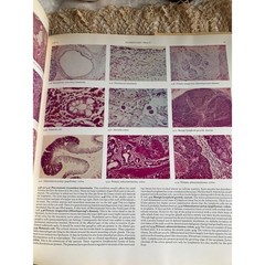 1972 Color Atlas of Histopathology Medical Reference Book by R.C. Curran Oxford