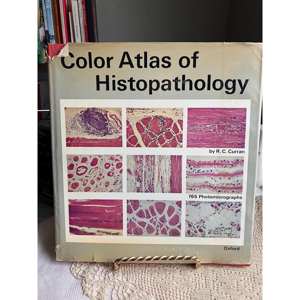 1972 Color Atlas of Histopathology Medical Reference Book by R.C. Curran Oxford