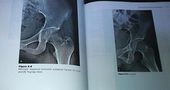 Atlas of Emergency Radiology, Johnson, Cohen, etc., 2001, Saunders – Like New